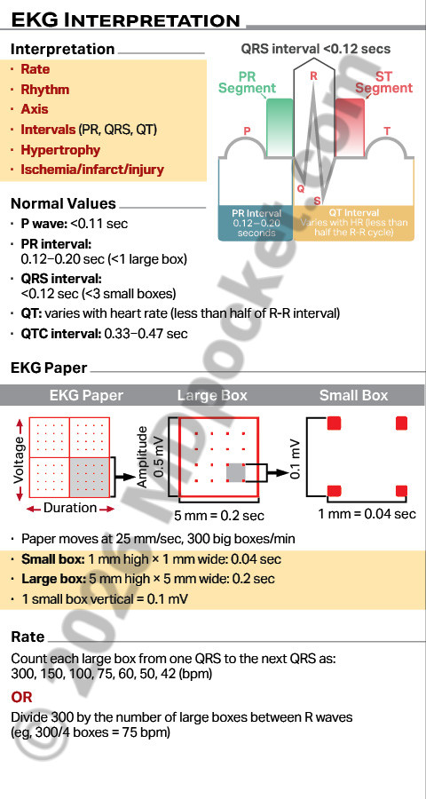 EKG