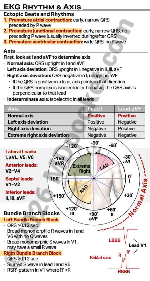 EKG