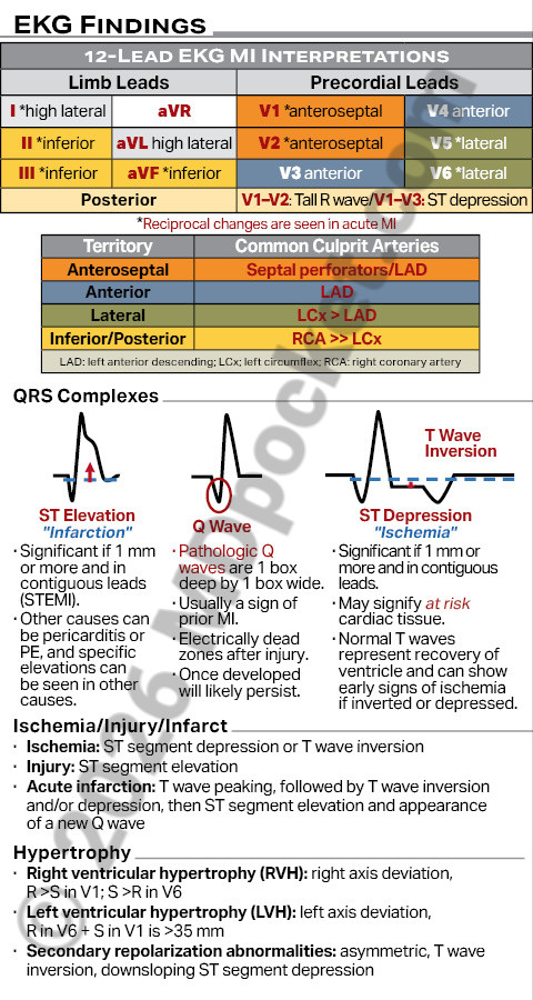 EKG