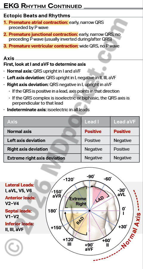 EKG_SNF