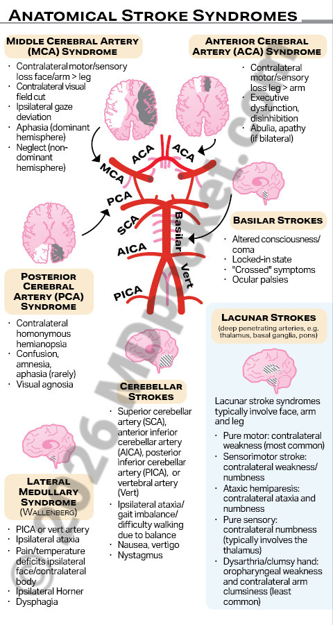Stroke_SNF
