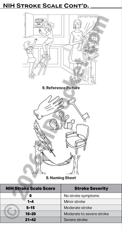 Stroke_SNF